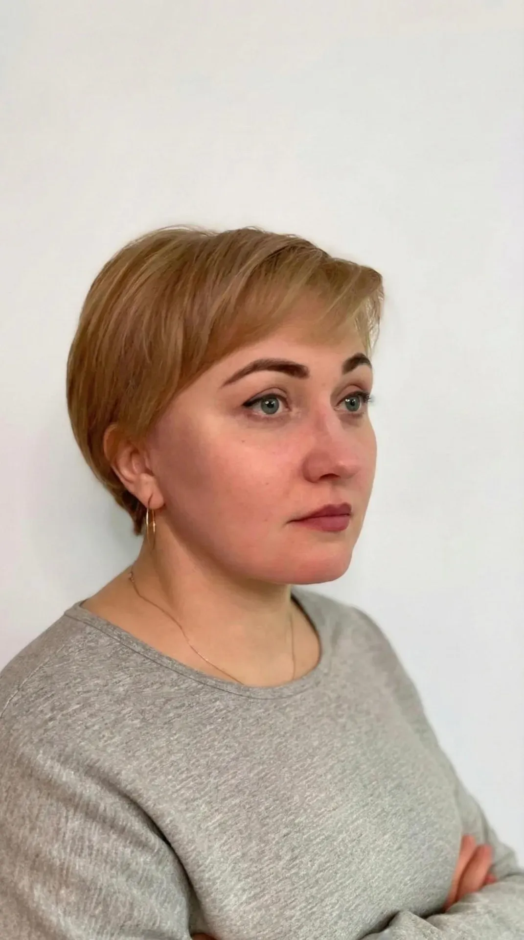 Омоложение лица и шеи — после