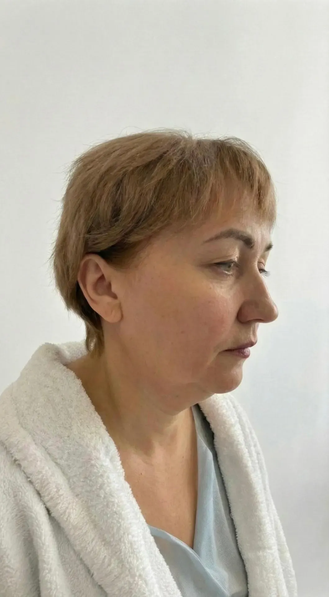 Омоложение лица и шеи — до